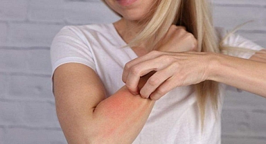 Alerjinizi iyi tanıyın