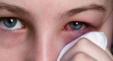 Göz Yaralanmaları En Sık Temmuz Ayında Görülüyor