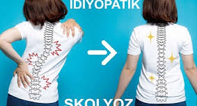 NADİR HASTALIK OLAN İDİYOPATİK