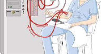 Diyalizde tehlike içeren 3 besin!