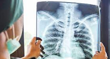 Sadece üşütmekle zatürre olunmaz