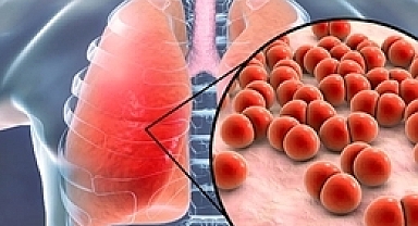 ZATÜRRENİN GÖZ ARDI EDİLMEMESİ GEREKEN 6 BELİRTİSİ