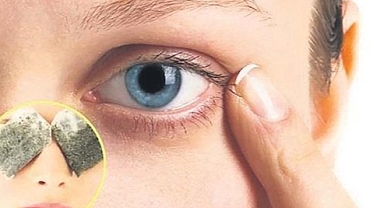 Göz çevresindeki koyu halkalara dikkat