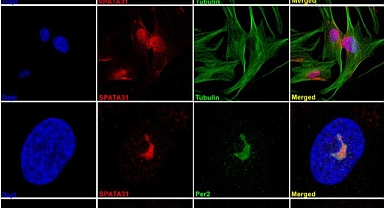 İnsanda bulunan SPATA31 geninin, yaşam uzunluğu ile orantılı olduğunu tespit edildi