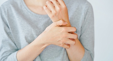 Sedef Hastalığı İlaçla Tedavi Edilebiliyor