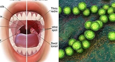 Beta (Strep A) Enfeksiyonu Yüzünden Oğlunu Kaybeden Annenin Farkındalık Çağrısı