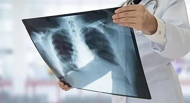 Korkutan açıklama: Yeniden artışa geçti