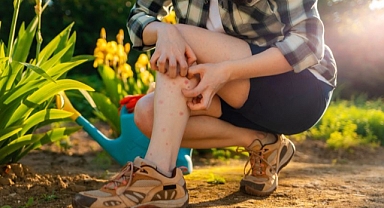 Sivrisinekler En Çok Hangi Kişilerin Kanını Emerler?