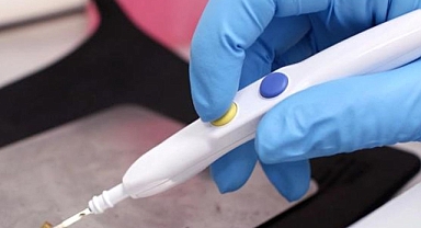 Tıp dünyasında devrim yaratan iKnife, kanseri saniyeler içinde tespit ediyor