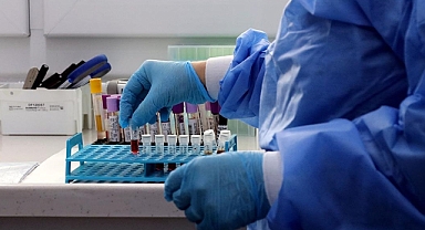 Depremde Hayatını Kaybeden Yakınını Arayanlar, Kimlik Tespiti İçin Kan Örneği Vermeli