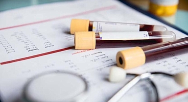 Kan bağışında bulunmak için bu koşullara dikkat!