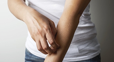 Uyuz vakalarında artış var, gözlerimizi nasıl korumalıyız?