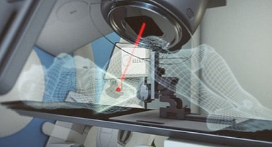 Kanser Tedavisinde Fark Yaratan Teknolojiler
