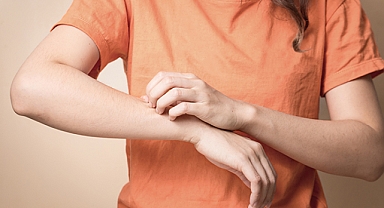 KAŞINTINIZ BİR HASTALIĞIN HABERCİSİ OLABİLİR