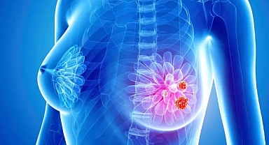 Yapay zekâ meme kanserini tespit edebiliyor