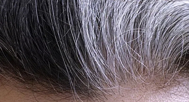 Araştırmacılar saç beyazlamasını önlemeye yaklaştı