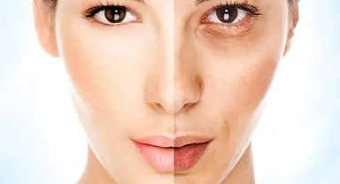 Deneyenler öneriyor! Cildi rengini en az 3 ton açıyor...