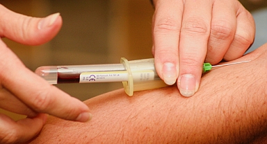 GÖZLERİNİZ ŞİŞ ŞEKİLDE UYANIYORSANIZ DİKKAT!