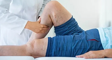 HAREKETSİZLİK VE SİGARA KULLANIMI DAMAR TIKANIKLIĞINA YOL AÇABİLİR