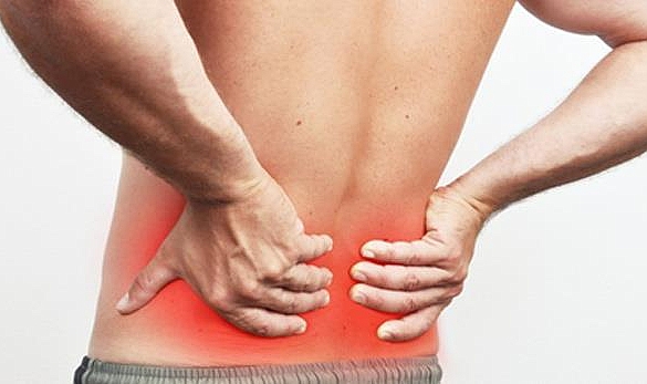 Her bel ağrısı fıtık olmayabilir