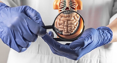 Huzursuz Bağırsak Sendromu Kadınlarda Daha Sık Görülüyor