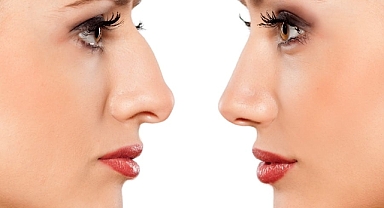 Kadın ile erkek burun estetiği arasında farklar bulunuyor 