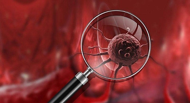 Kanserin en sık görülen 12 belirtisi