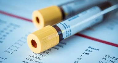 KÖK HÜCRE TEDAVİSİ İLE PRP ARASINDAKİ 4 ÖNEMLİ FARK