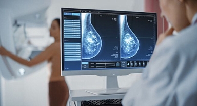 Prof. Dr. Umut Barbaros: “Kanserde Umut Işığı, Sıcak Kemoterapi” 