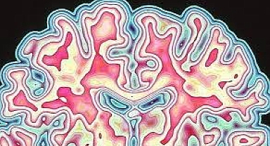 Psikiyatri teşhis ve sınıflandırmada nörogörüntüleme odaklı akıllı öngörü modelleri 