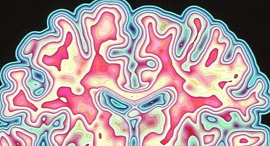 Psikiyatri teşhis ve sınıflandırmada nörogörüntüleme odaklı akıllı öngörü modelleri