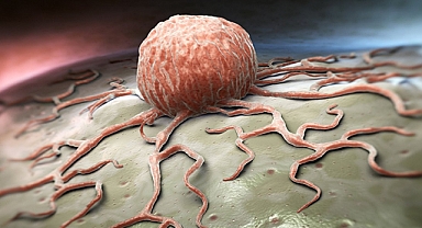 Stres kanserin tetikleyici faktörleri arasında Stres kanserin tetikleyici faktörleri arasında 