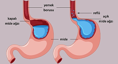 BAHARDA REFLÜ HASTALIĞI TETİKLENİYOR!