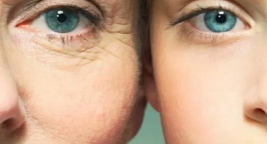 Cildinizdeki kırışıklıklar için en etkili cilt bakımı! Yaşlılık izlerine savaş açıyor