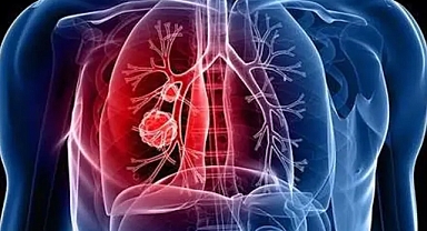  Dolaşım sistemi hastalıklarına dikkat! 