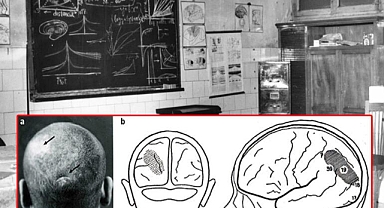 ''EN TUHAF VAKA'' Başından vuruldu, tersten görmeye başladı! 