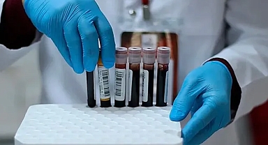 En zeki kan grubu belirlendi! Hangi Kan Grubunun IQ’su daha yüksek?