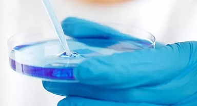 Ölümcül bakteriye yapay zekayla antibiyotik bulundu