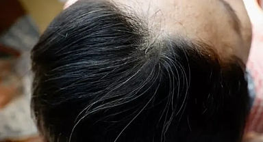 Saç beyazlarını 1 saatte kapatan mucize gibi yöntem!