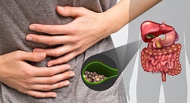 SAFRA KESESİ HASTALIKLARI KADINLARDA DAHA ÇOK GÖRÜLÜYOR 