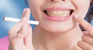 Sigara, kola ve çay diş sararmasını tetikliyor