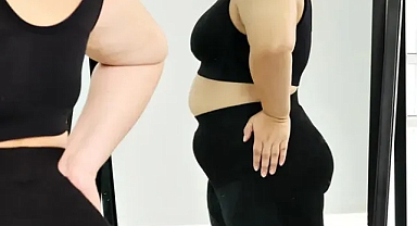 'Türkiye’de her 3 yetişkinden birinde obezite var' 