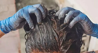 1 saatte beyaz saçları siyaha çeviriyor! Beyaz saç kapatıcı en doğal çözüm, bu formül ezberleri bozdu