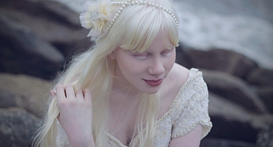 13 Haziran Dünya Albinizm Günü ''Beyaz Melekler''