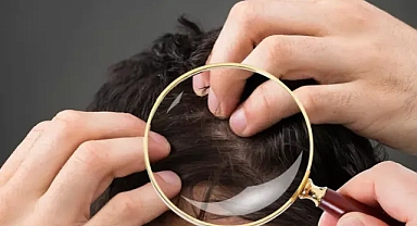 Saç diplerindeki egzama ve kaşıntıyı tek damlada bitiren yöntem! Gece sürmek etkisini 2 kat artırıyor