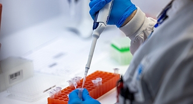 DSÖ, Kovid-19 vakalarında dünya genelinde artış yaşandığını açıkladı