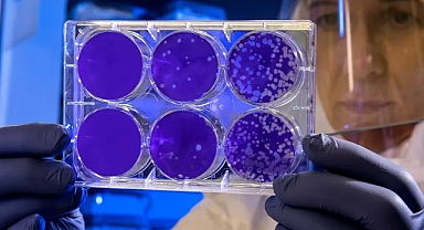 Musluk suyu ve gıdalardaki 'kimyasallar' kanserin yayılmasına neden olabilir | Araştırma