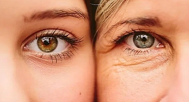 Cilt yaşlanmasına karşı altın çözüm