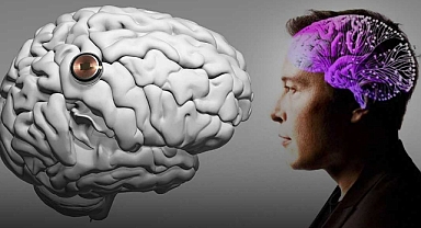 Neuralink’ten Yeni Bir Adım: İkinci İnsana Beyin İmplantı