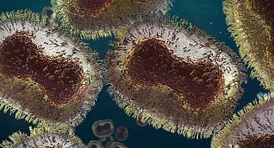 M çiçeği virüsü çocuklar için daha tehlikeli!